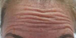best skin clinic in gurugram