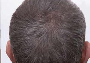 best skin clinic in gurugram