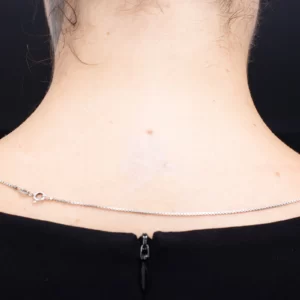 best skin clinic in gurugram