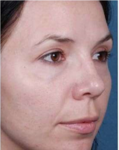 best skin clinic in gurugram