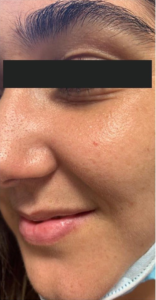 best skin clinic in gurugram
