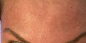 best skin clinic in gurugram