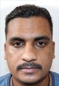 best skin clinic in gurugram