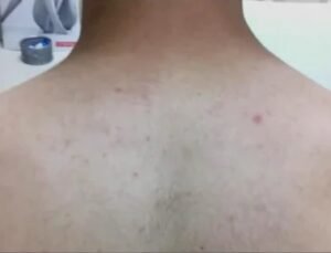 best skin clinic in gurugram