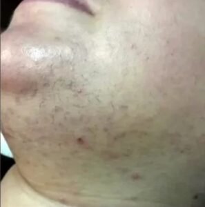 best skin clinic in gurugram