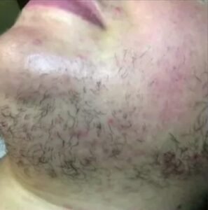 best skin clinic in gurugram