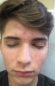 best skin clinic in gurugram best skin clinic in gurugram