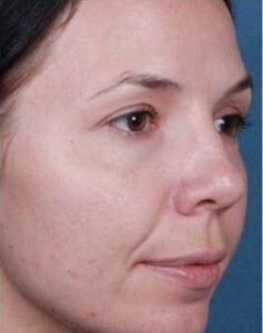 best skin clinic in gurugram