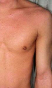 best skin clinic in gurugram best skin clinic in gurugram