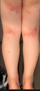 best skin clinic in gurugram best skin clinic in gurugram