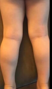 best skin clinic in gurugram best skin clinic in gurugram