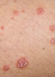 best skin clinic in gurugram