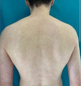 best skin clinic in gurugram